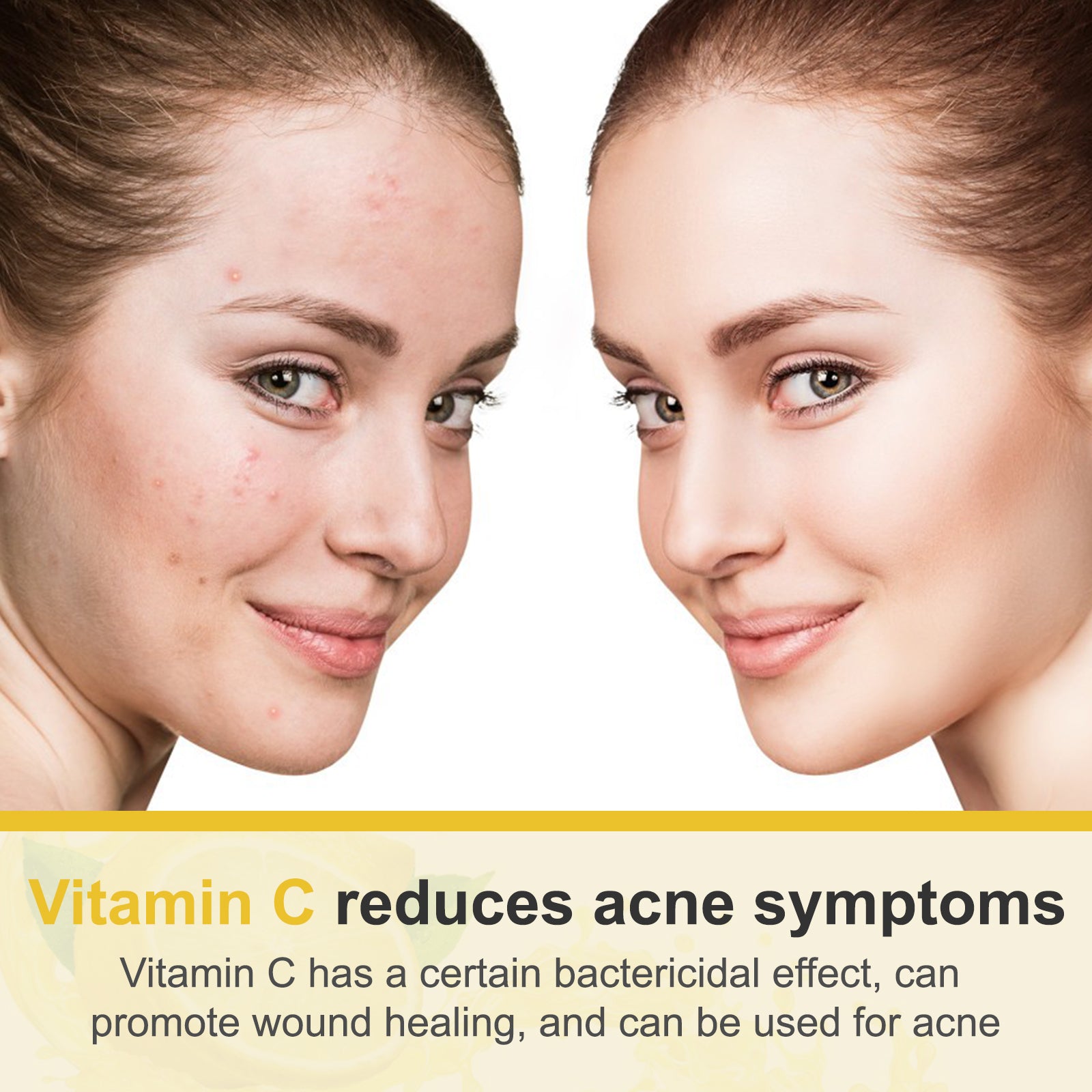 Akeeronn ADVANCED VITAMIN C CREAM